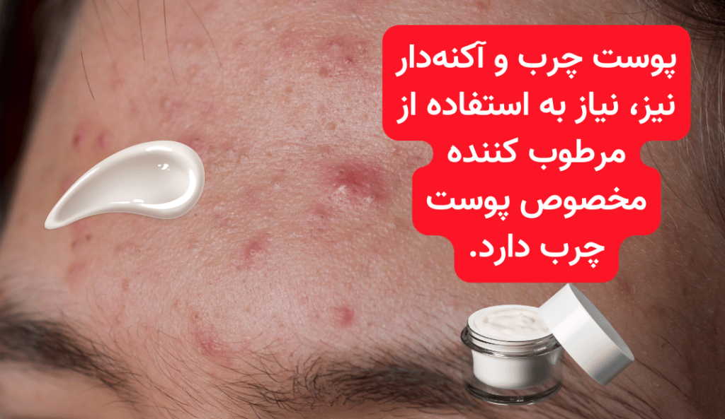 سه راز درباره استفاده از مرطوب‌ کننده پوست چرب که نمی‌دانستید