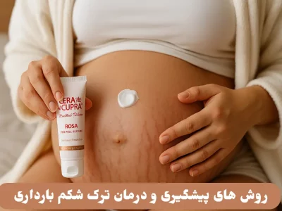 روش های پیشگیری و درمان ترک شکم بارداری