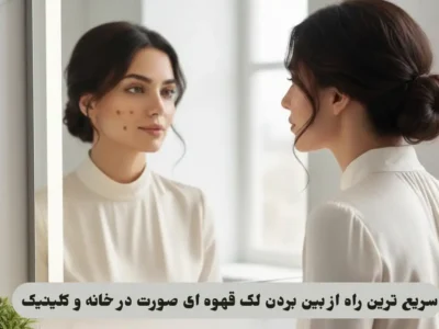 لک قهوه ای صورت