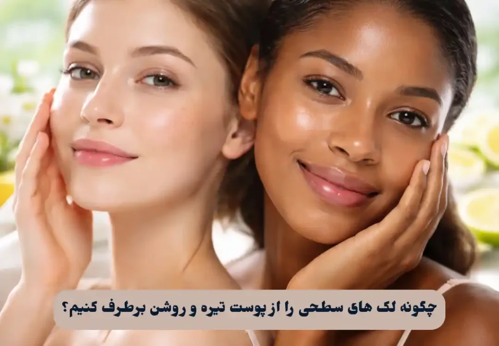 لک های سطحی