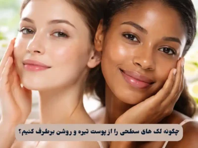 لک های سطحی