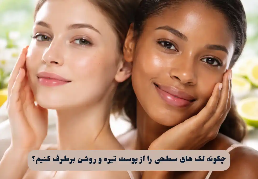 لک های سطحی